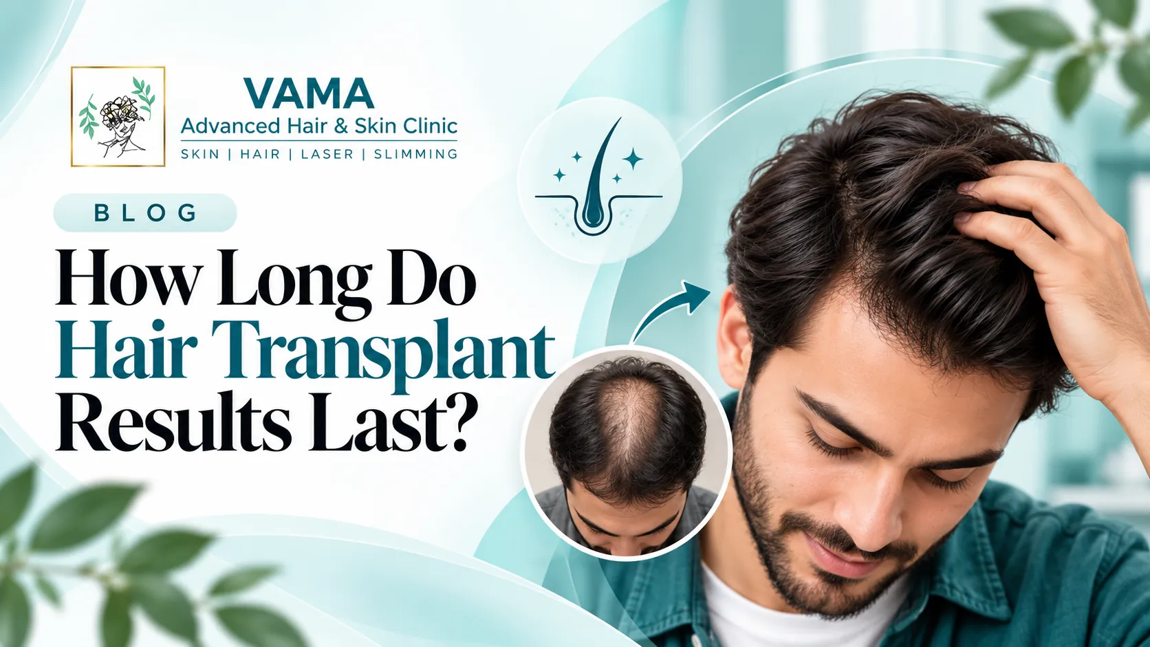How Long Do Hair Transplant Results Last?