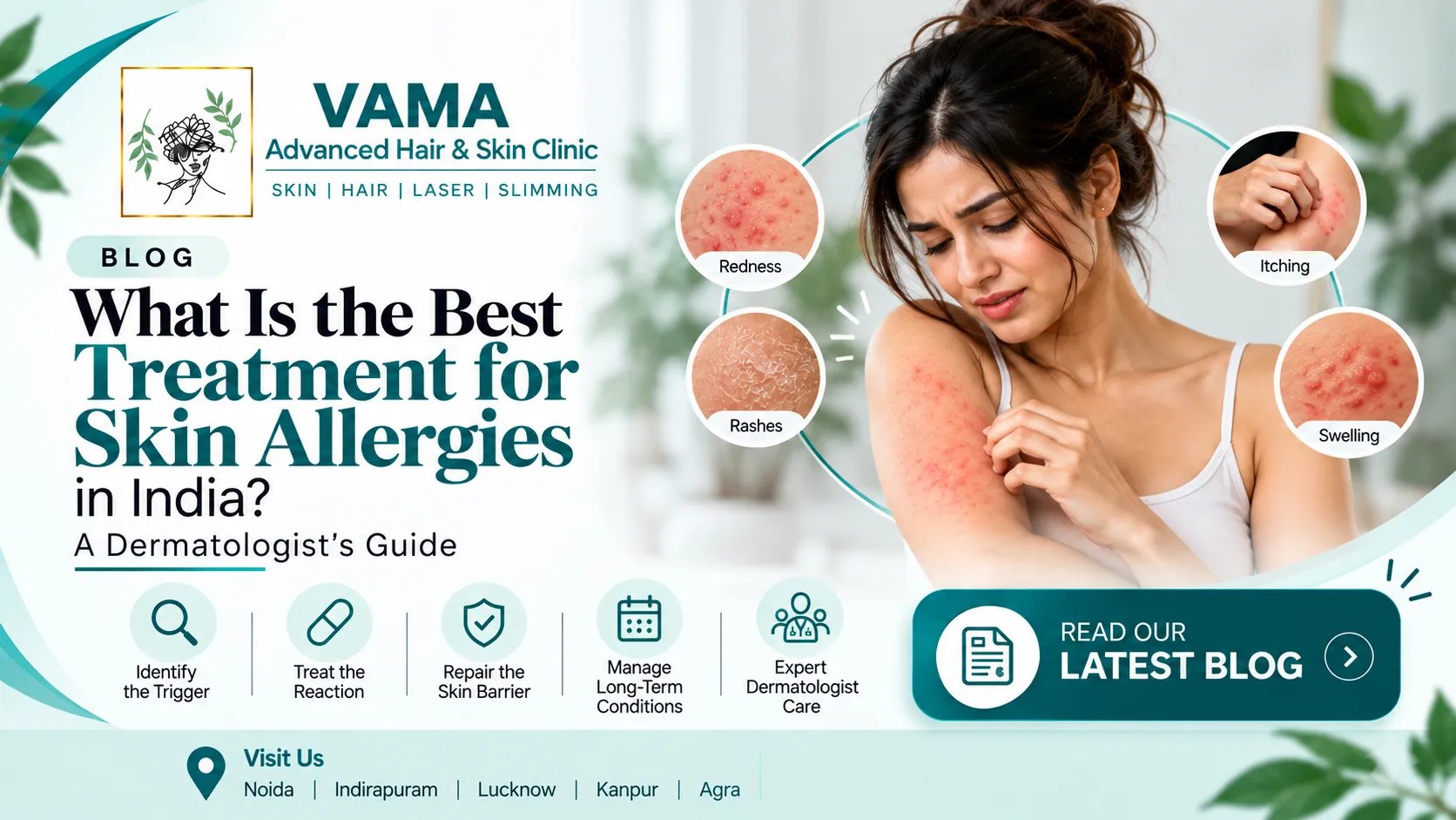 What Is the Best Treatment for Skin Allergies in India? A Dermatologist's Guide