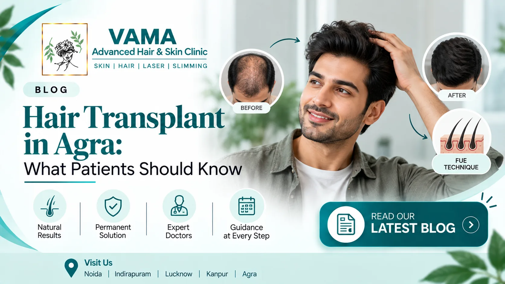 What Every Patient in Agra Should Know Before Getting a Hair Transplant?