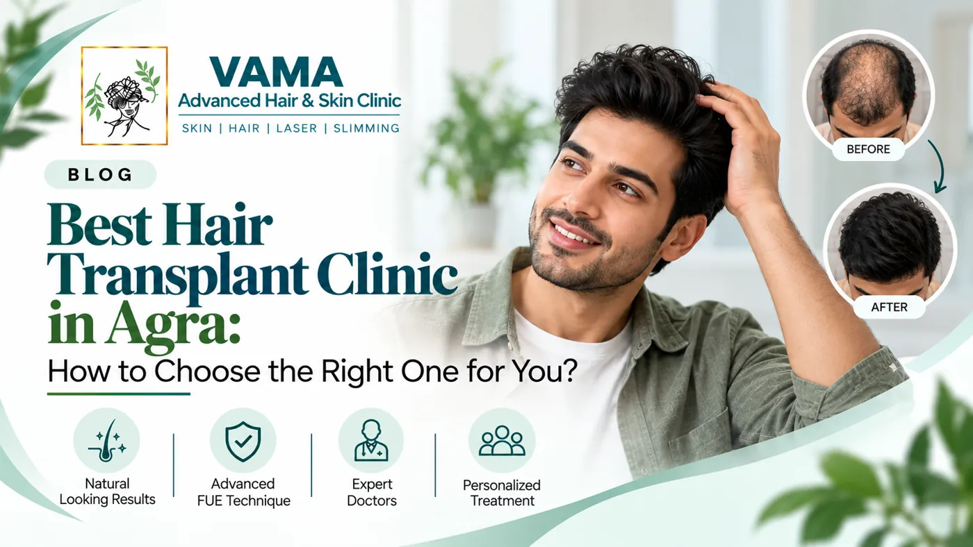 Best Hair Transplant Clinic in Agra: How to Choose the Right One for You?